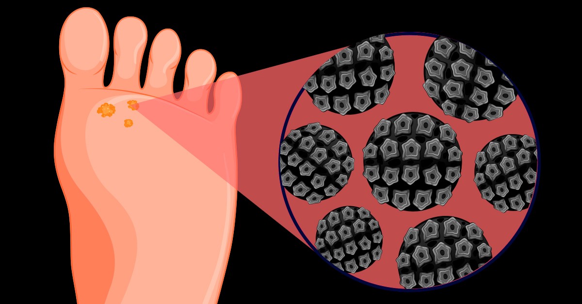 Disintossicare il corpo dai piedi