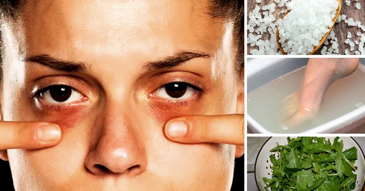 Bruciore ai piedi e ansia