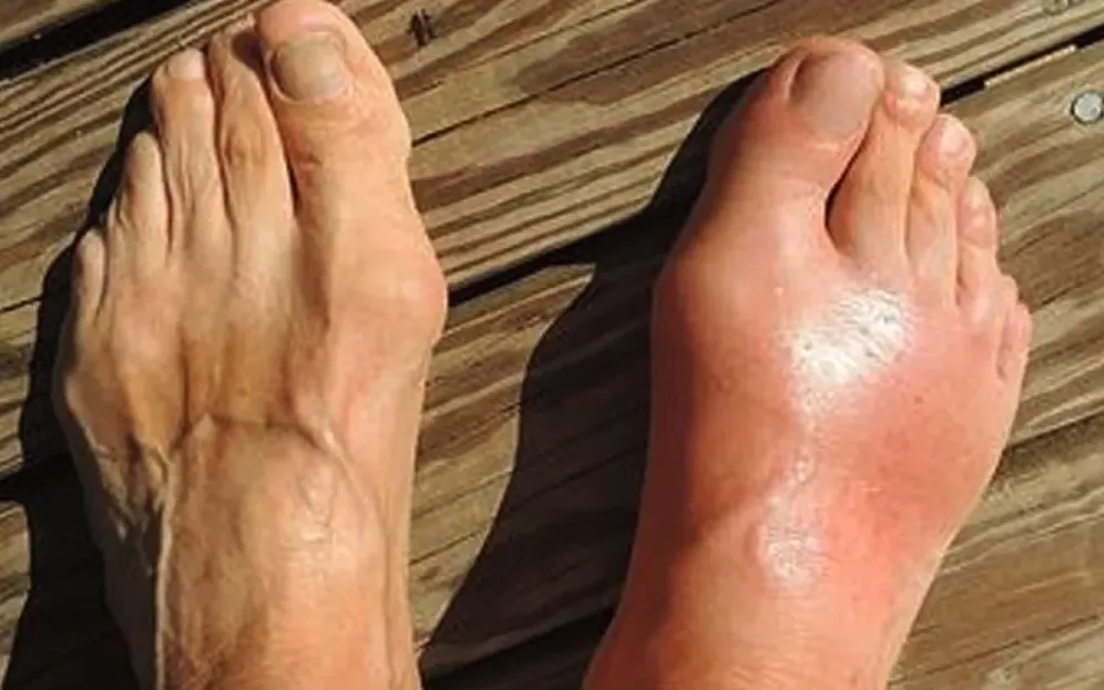 feet