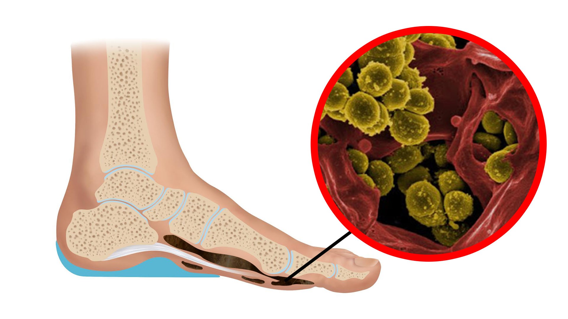 Rimedi della nonna per la circolazione del sangue