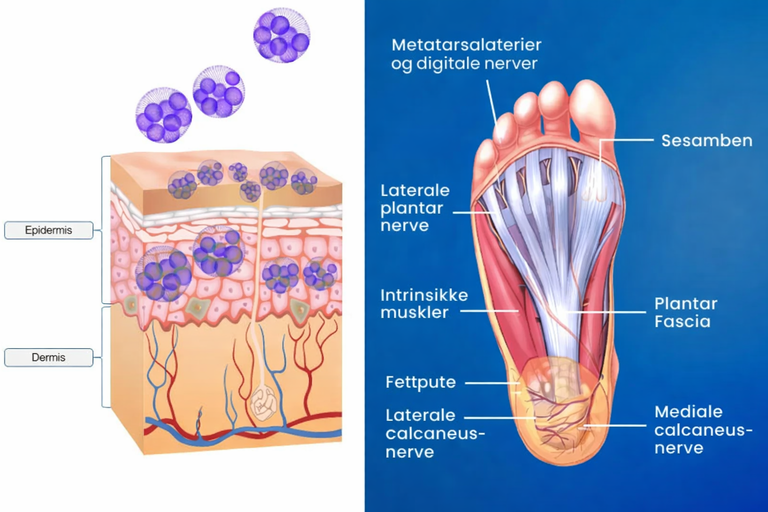 Nuubu 2 split edema NB