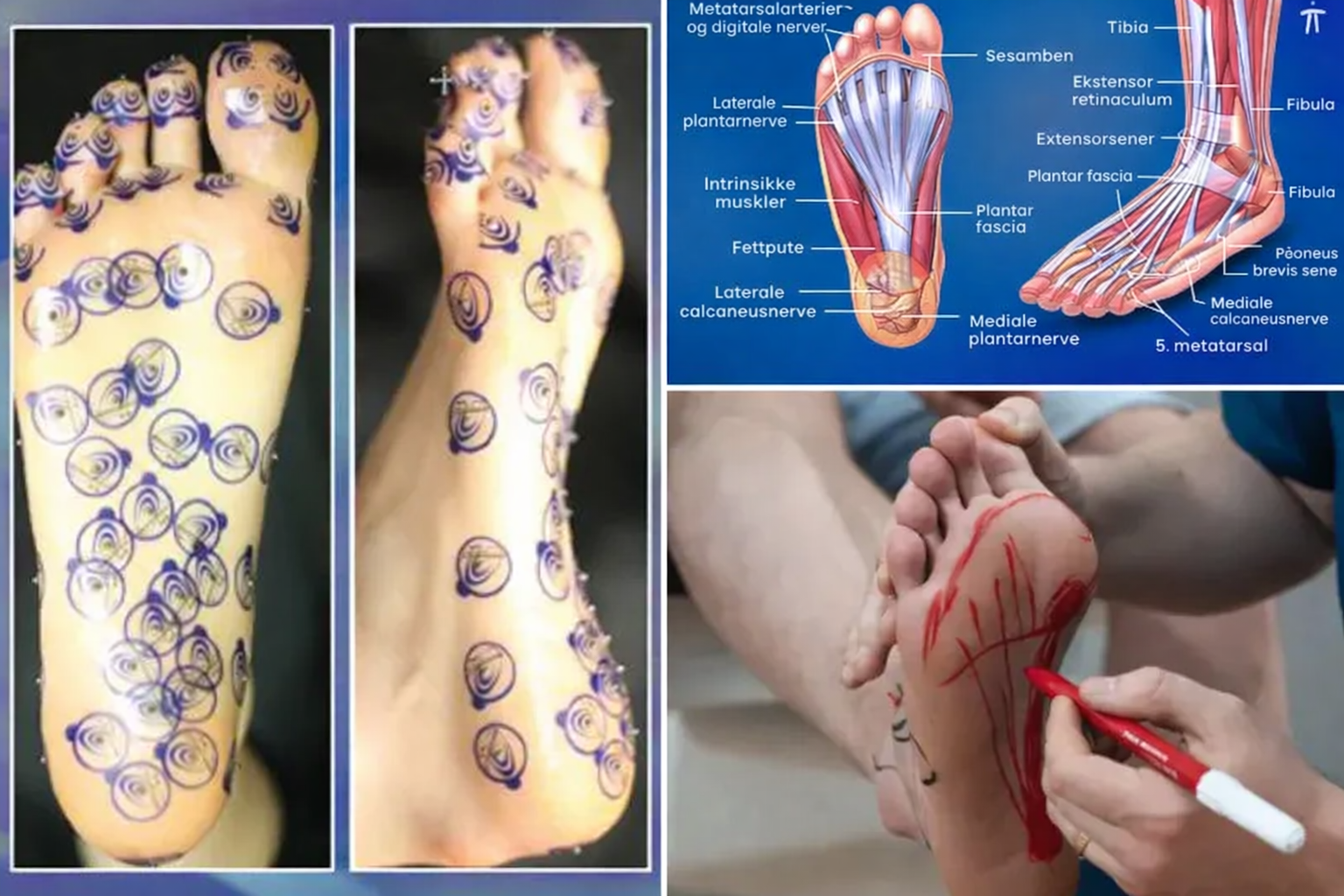 Nuubu 3 block edema NB